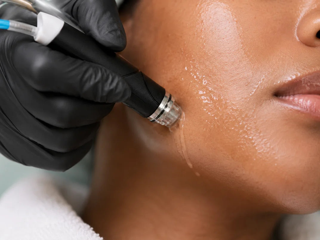 Neck Botox for platysmal bands and Nefertiti lift