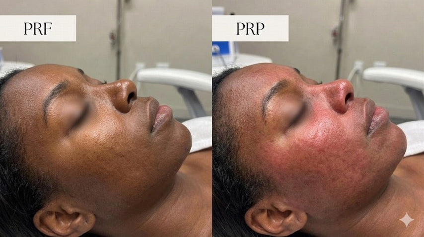 PRF vs. PRP: What's the Difference and Which Is Better?