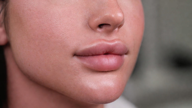 The 3-Point Approach to Facial Balancing with Chin, Jawline &amp; Cheek Filler