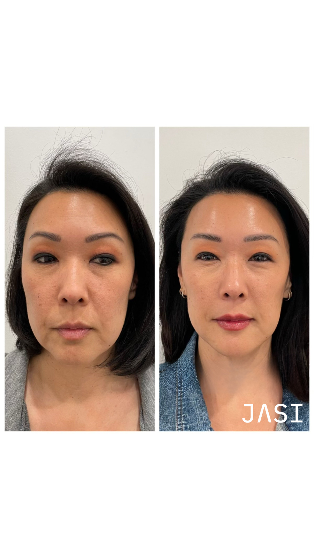 Before & After Result