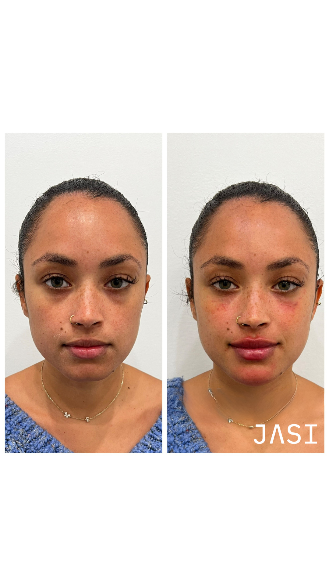 Before & After Result