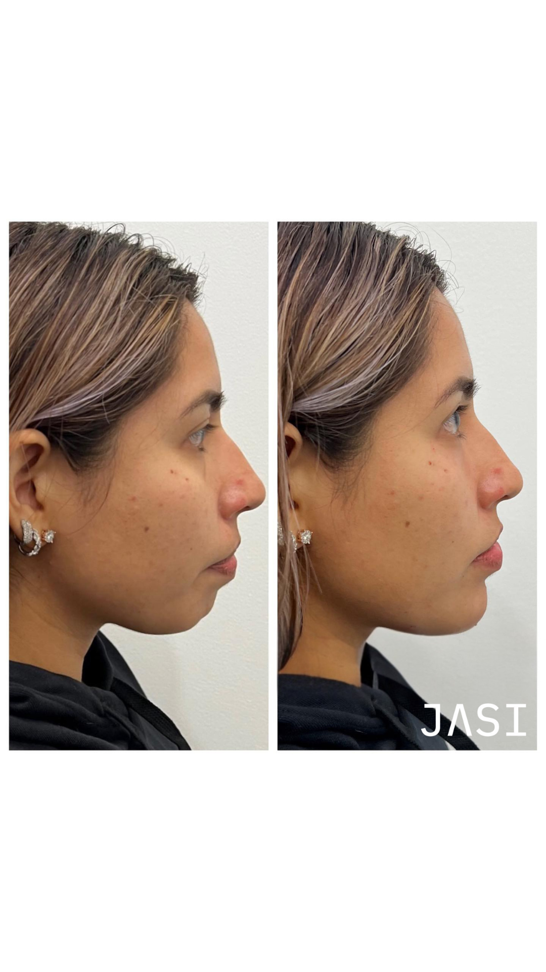 Before & After Result