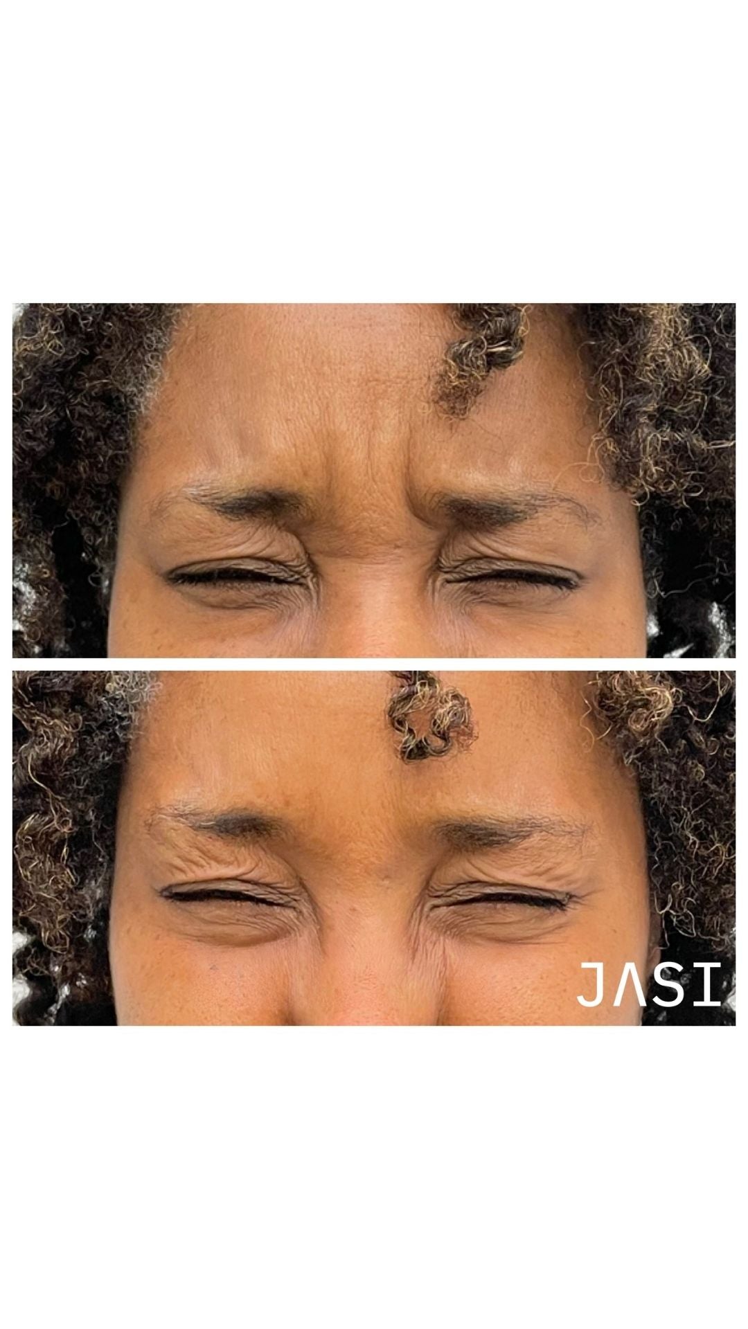 Before & After Result