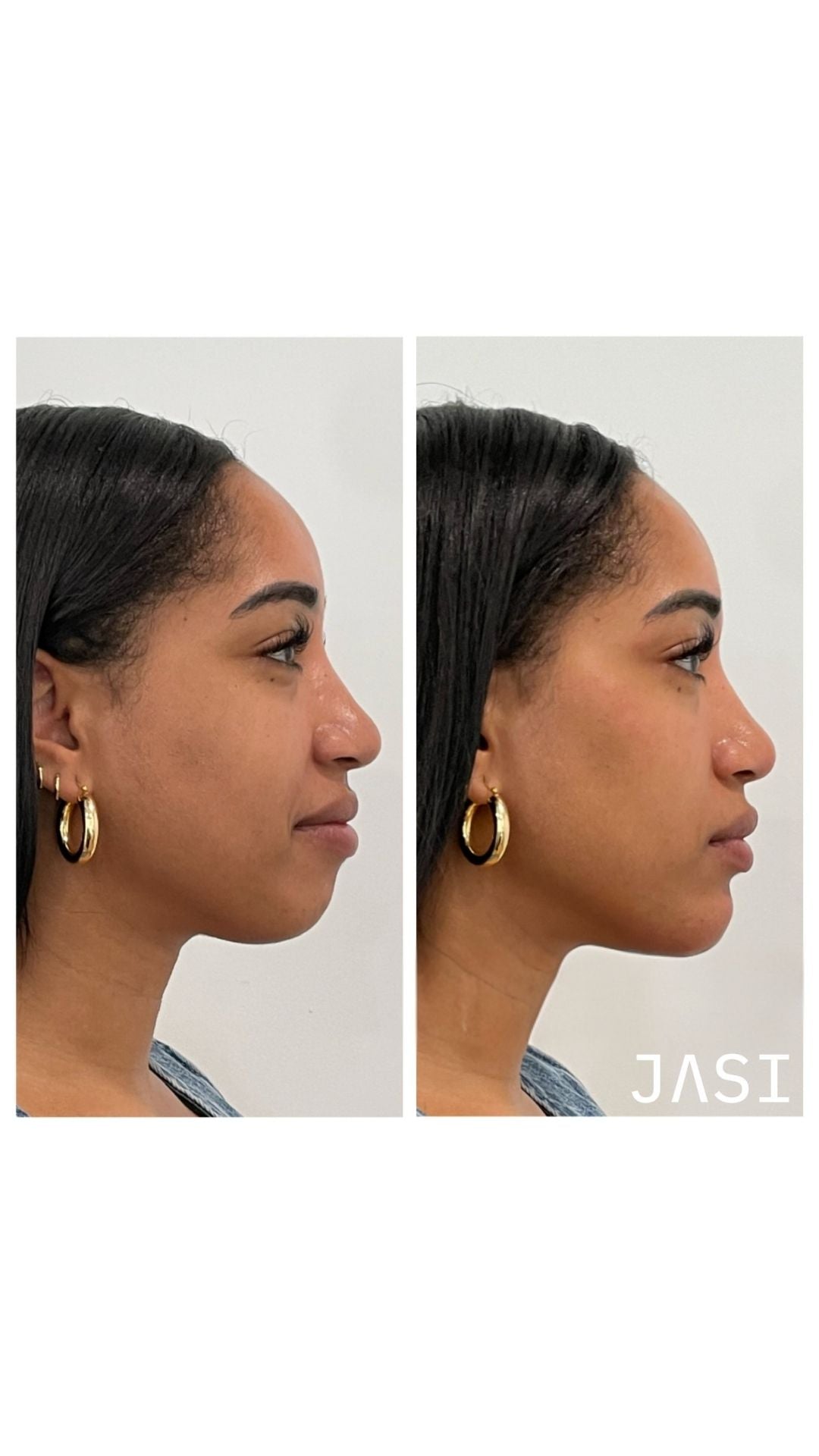 Before & After Result