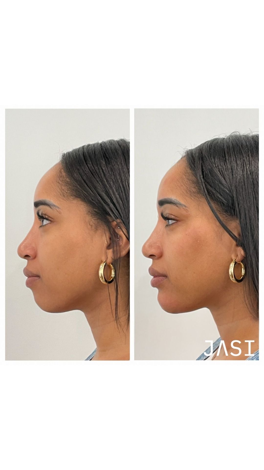 Before & After Result