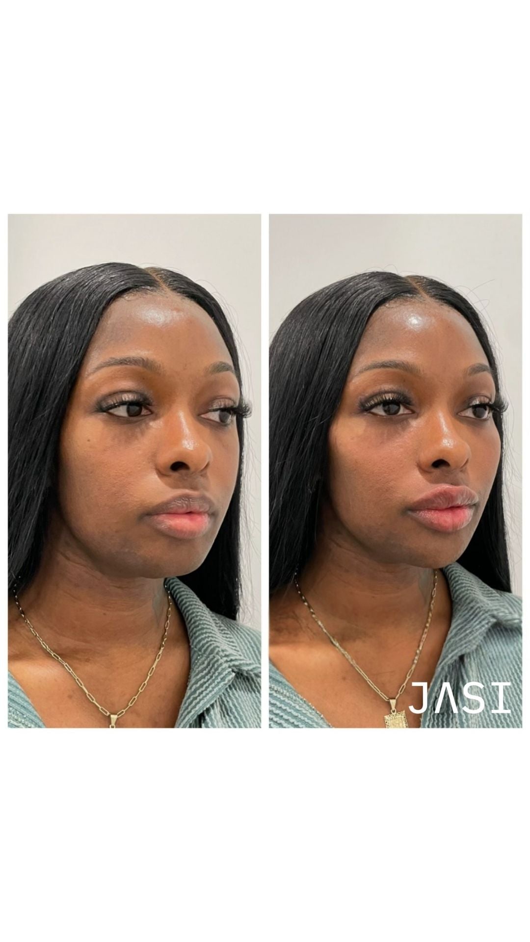 Before & After Result