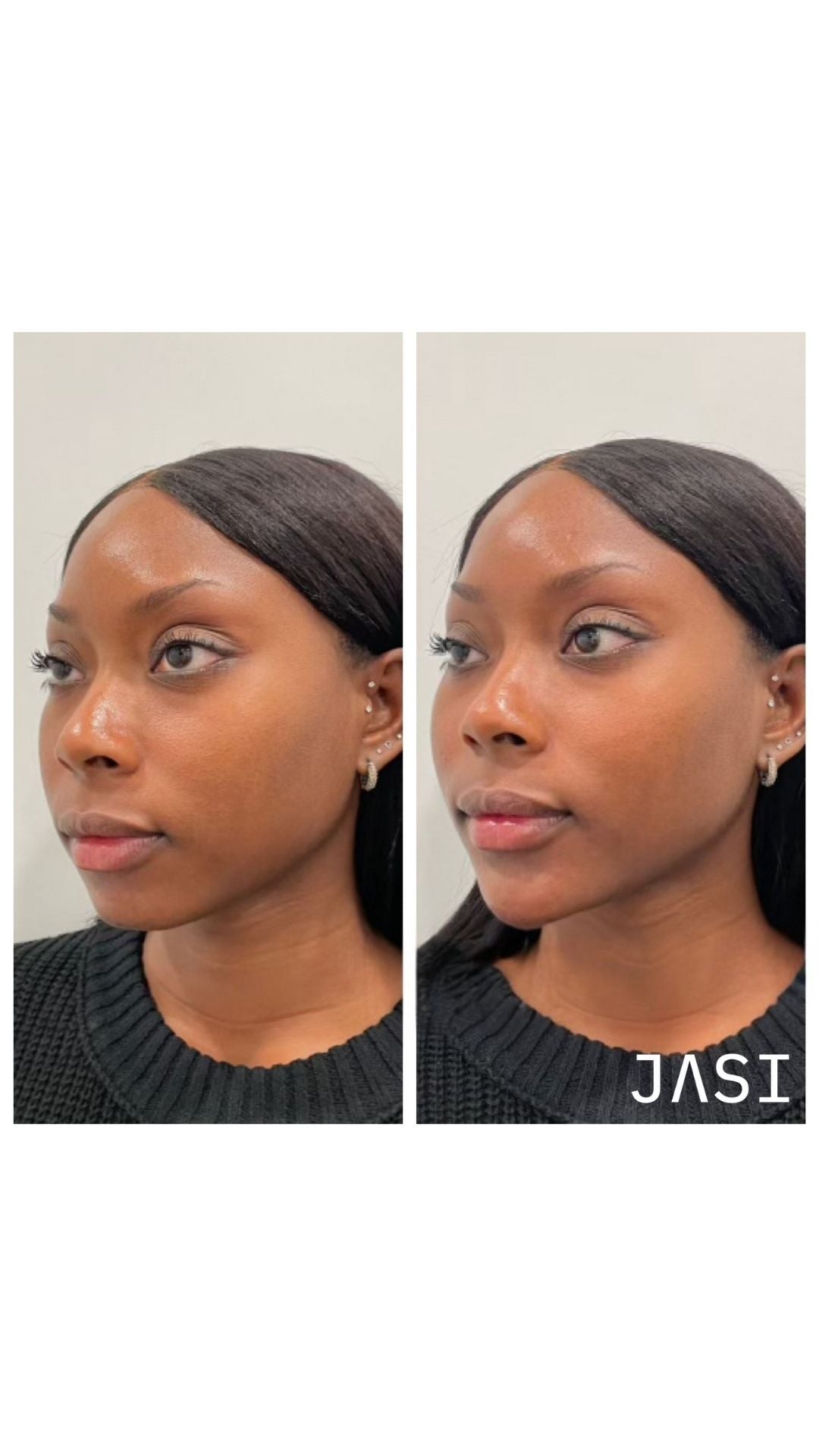 Before & After Result