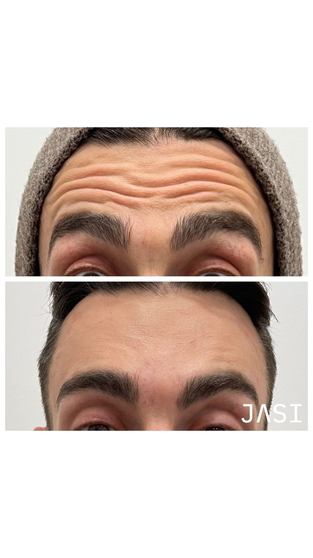 Before & After Result