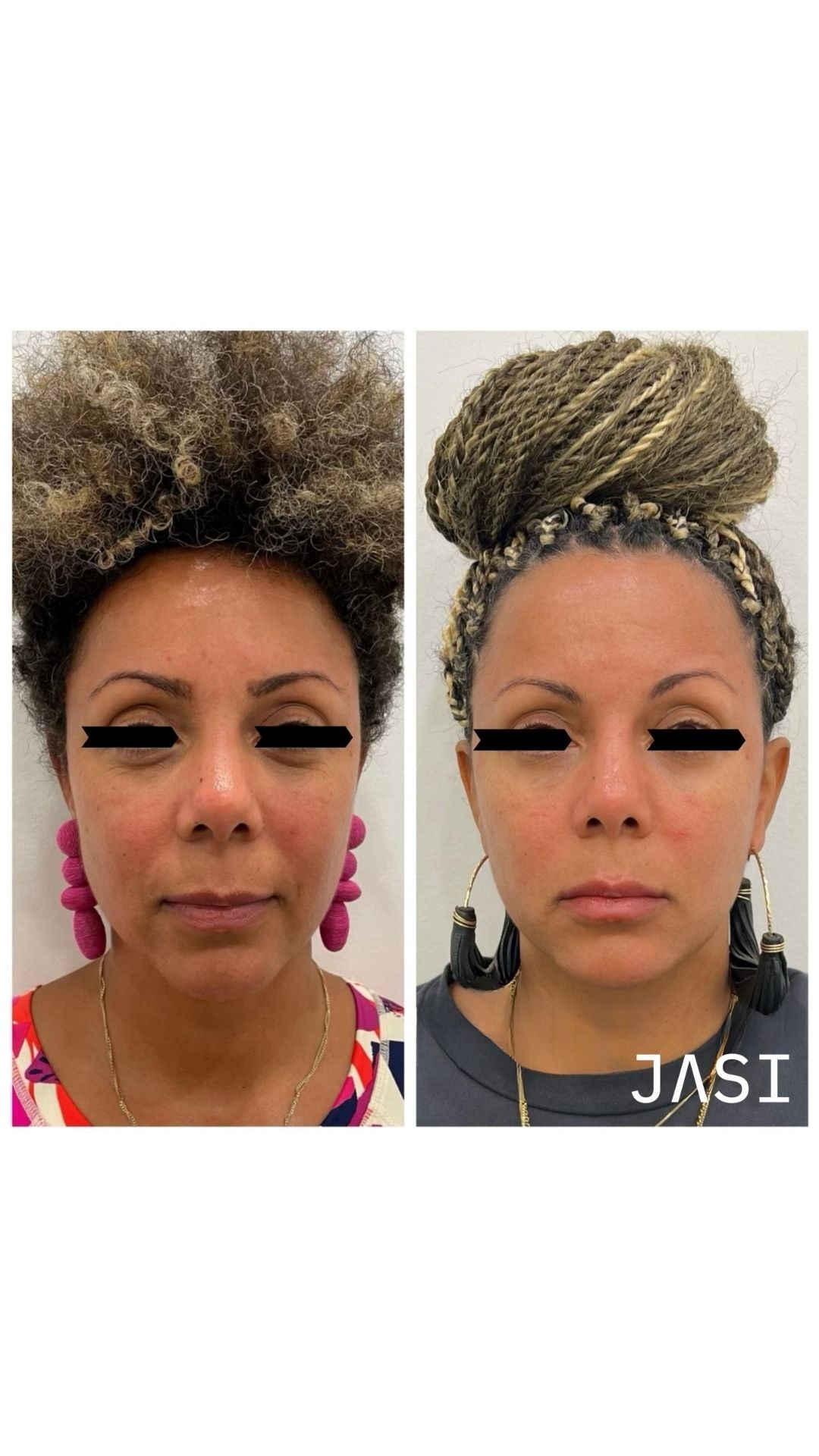 Before & After Result