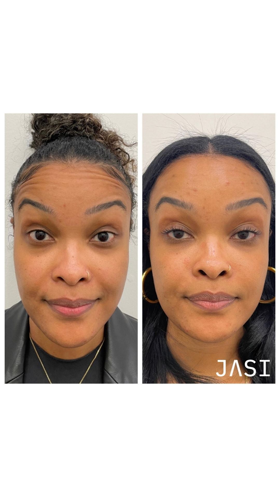 Before & After Result