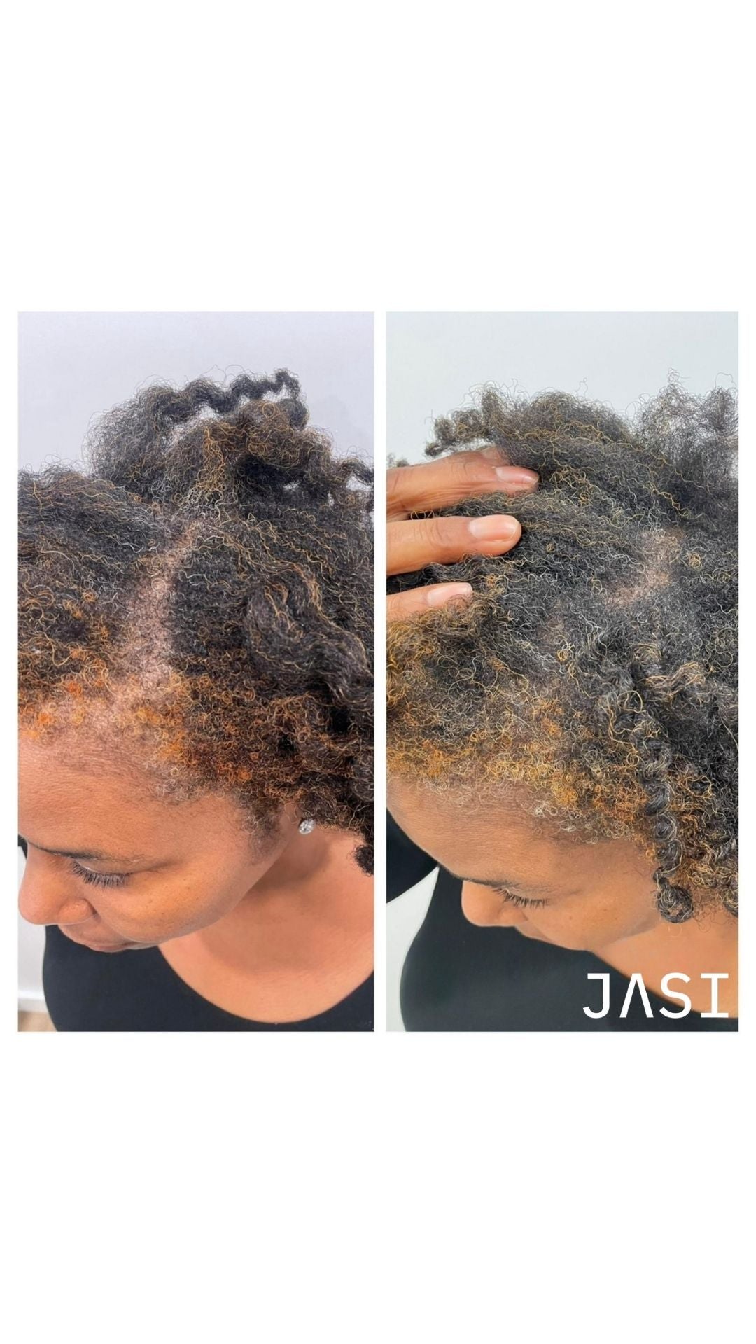 Before & After Result