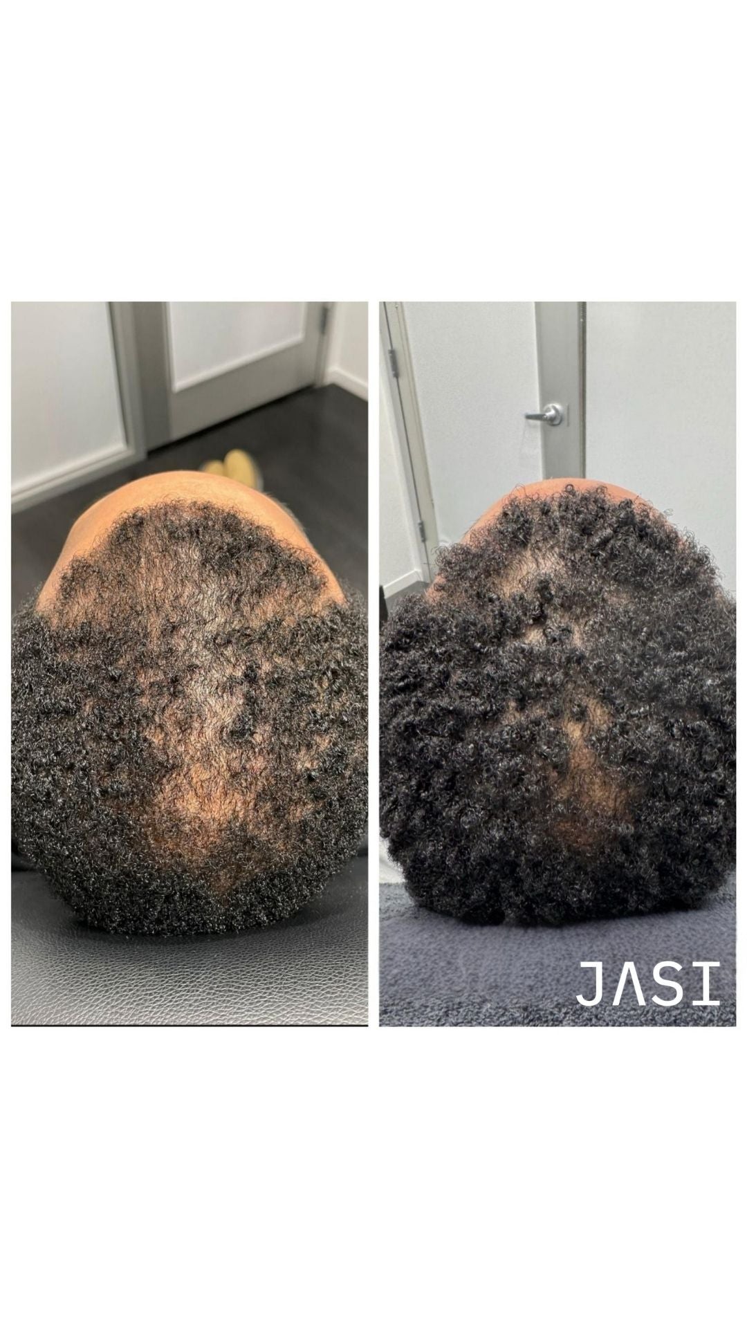 Before & After Result