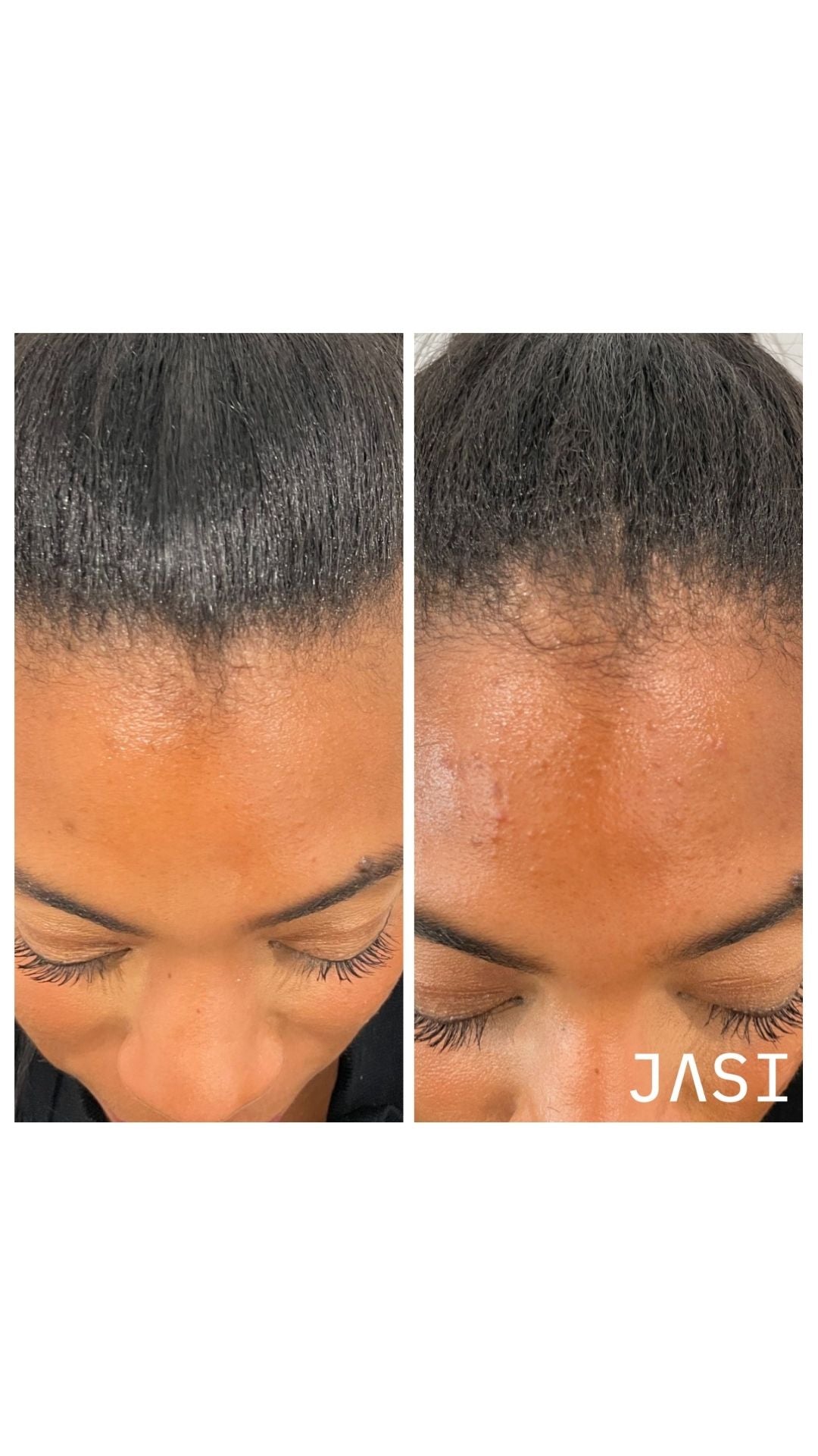 Before & After Result