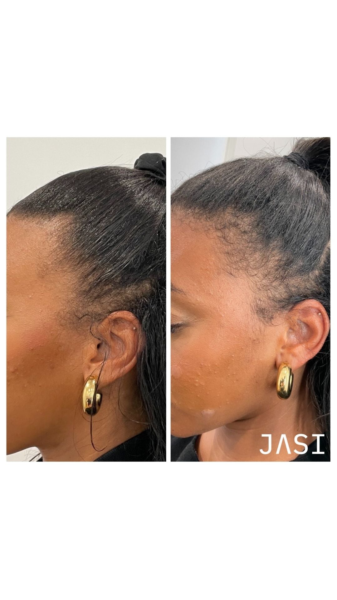 Before & After Result